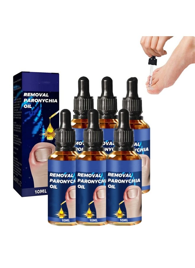 6Pcs German Toenailcare Removal Paronychia Oil Ingrown Toenail Nail Repair German Toenailplus Oil Nail Renewal Liquid - pzsku/Z23F18B2F44142E3EB602Z/45/_/1720698705/099574c9-bb18-4c15-ab2a-4ae5f6661a58