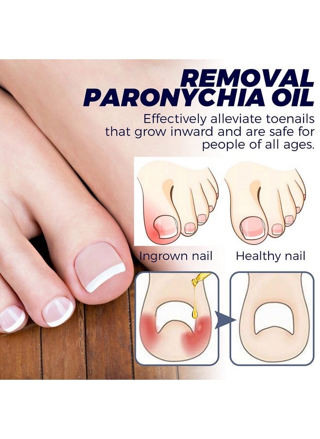 6Pcs German Toenailcare Removal Paronychia Oil Ingrown Toenail Nail Repair German Toenailplus Oil Nail Renewal Liquid - pzsku/Z23F18B2F44142E3EB602Z/45/_/1720698814/1b64db78-c08f-4b88-bc20-bb9be70d4344