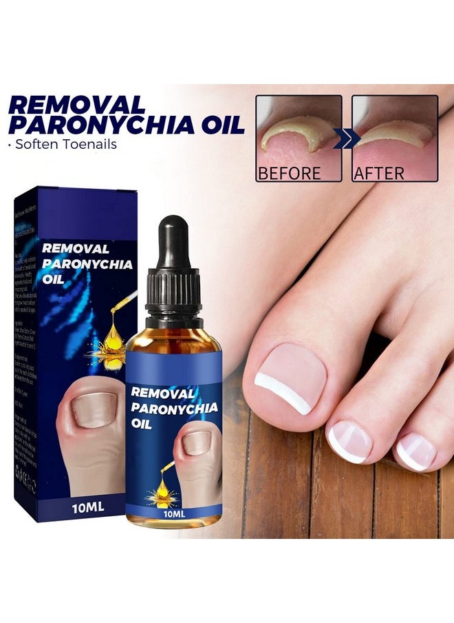 6Pcs German Toenailcare Removal Paronychia Oil Ingrown Toenail Nail Repair German Toenailplus Oil Nail Renewal Liquid - pzsku/Z23F18B2F44142E3EB602Z/45/_/1720698840/2324a481-9970-4261-8d0f-21e480971c3d