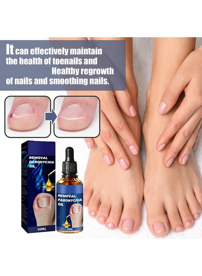 6Pcs German Toenailcare Removal Paronychia Oil Ingrown Toenail Nail Repair German Toenailplus Oil Nail Renewal Liquid - pzsku/Z23F18B2F44142E3EB602Z/45/_/1720698892/b6506d3b-ff67-4303-989b-21206467d0ee