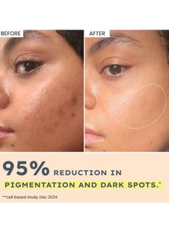 HYPHEN 44% Rice Water Brightening Face Serum Pads | 5% Niacinamide & Alpha Arbutin to Reduces Dark Spots & Pigmentation | Toner Pads with Serum for Glowing Glass Skin | All Skin Types - 50N  - Image 4