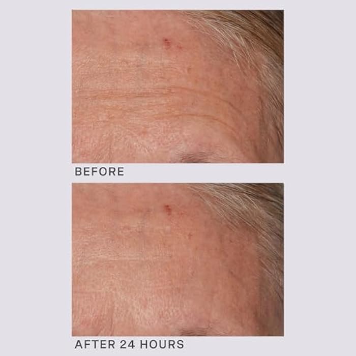 Lancer Gravity Defying Moisturizer With Firming Technology, Face Moisturizer for Women, Great at Boosting Collagen, Hydration, Anti-Aging and Firmness - Image 5