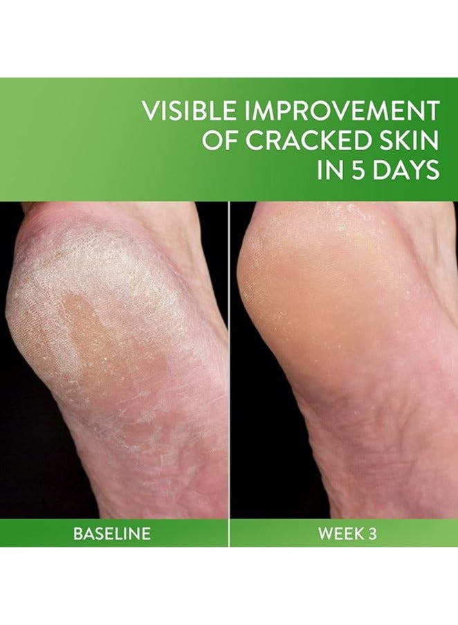 CETAPHIL Cracked Skin Repair Balm, 3 oz, (85 g)For Very Rough & Cracked, Sensitive Skin, Protects, Soothes & Restores Deeper Cracks, Hypoallergenic, Fragrance Free - Image 4