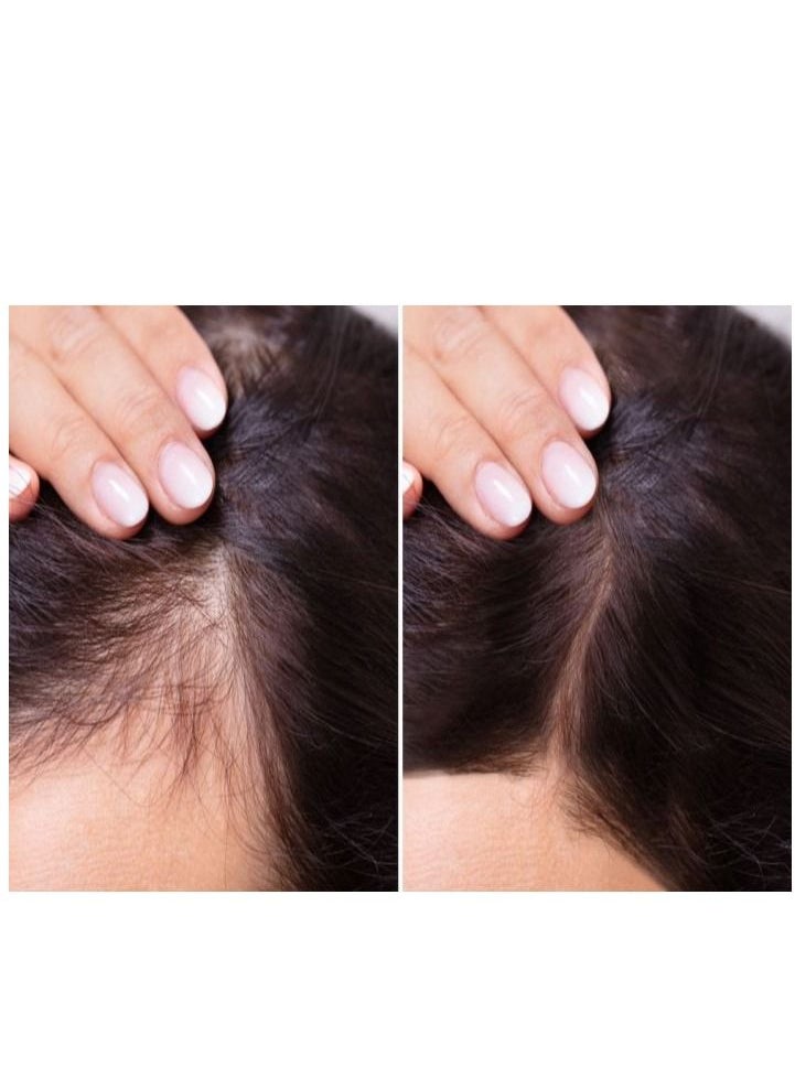 GENSENG CAPILLARE - Ampoules For Hair Growth 12 x 10 ml - Image 1