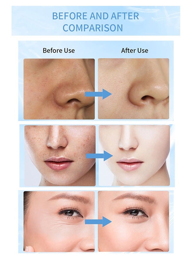 QANZIRE 5% B3 Niacinamide Serum- Niacinamide Face Serum for Women & Men, Skin Brightening Serum Face Care, Anti Aging Serum for Face, Dark Spot Remover Serum, Hydrating Serum, Even Skin Tone 30ml - Image 5