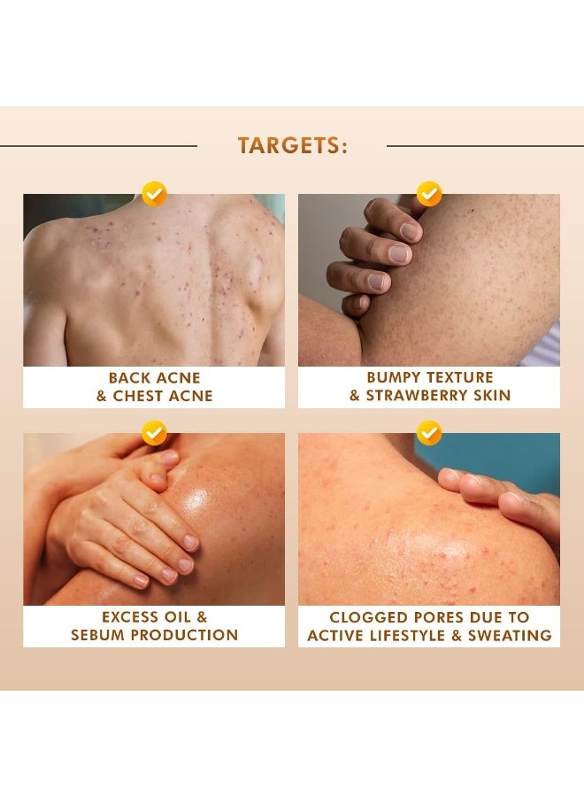 إم كافيين غسول الجسم المقشر إم كافيين ٢٪ حمض اللاكتيك، ٣٠٠ مل | يقلل من حب الشباب، وبشرة الفراولة، والشعر الناشئ تحت الجلد، وينعم البشرة | جل استحمام برائحة الكراميل الحلو، للرجال والنساء - جميع أنواع البشرة - Image 2