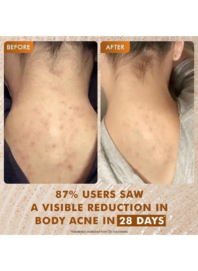 إم كافيين غسول الجسم المقشر إم كافيين ٢٪ حمض اللاكتيك، ٣٠٠ مل | يقلل من حب الشباب، وبشرة الفراولة، والشعر الناشئ تحت الجلد، وينعم البشرة | جل استحمام برائحة الكراميل الحلو، للرجال والنساء - جميع أنواع البشرة - Image 4