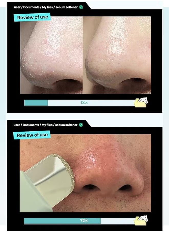 ilso Super Melting Sebum Softener 150g, Sebum Remove Complex Centella Asiatica Extract, Carica Papaya Fruit Extract, Blackhead Remove, Melting Sebum Softener, Pores Cleanses  - Image 5