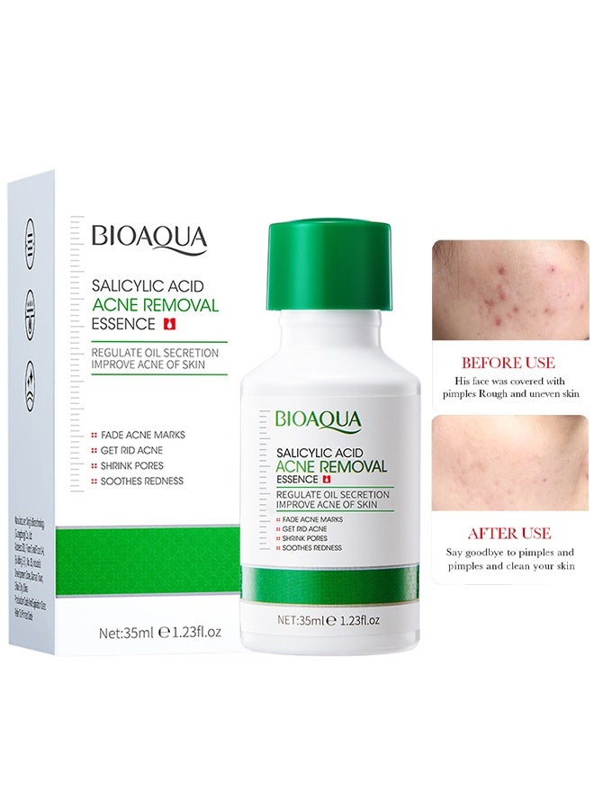 BIOAQUA Salicylic Acid Acne Removal Essence - Oily Skin | Helps Improve the Appearance of Enlarged Pores, Pimples, Blackheads and Uneven Texture, Moisturizing and shrinking Essence, 35 ml - Image 1