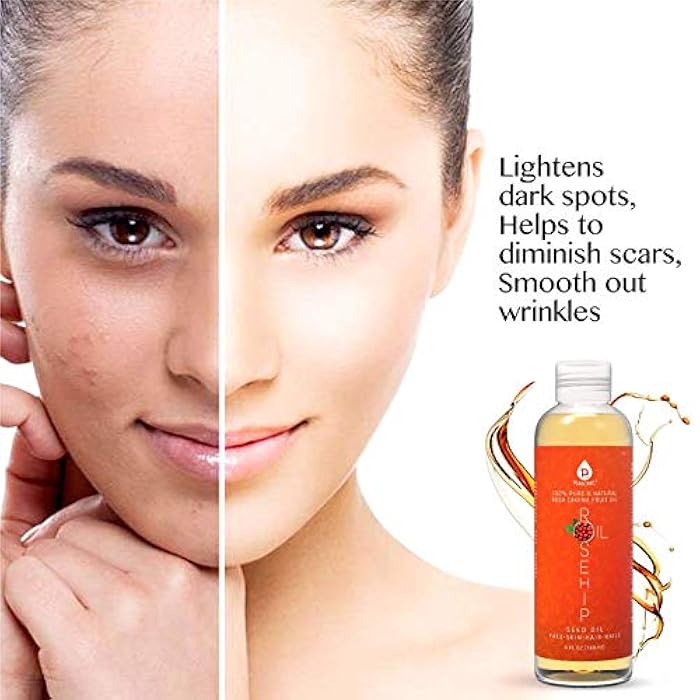 Pursonic 100% Pure Cold-Pressed Rosehip Oil – 6 FL oz Moisturizing Facial Oil for Face, Hair, Skin & Nails,Anti-Aging, Hydrating, Brightening, Scar & Stretch Mark Care - Pack of 1 - Image 5
