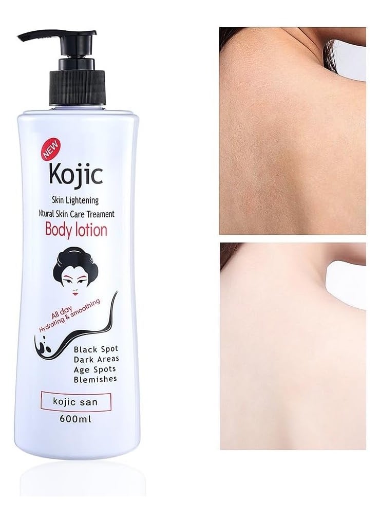 GuanJing Beauty - Kojic Skin Lightening Body Lotion Your Natural Skin Care Solution - Image 1