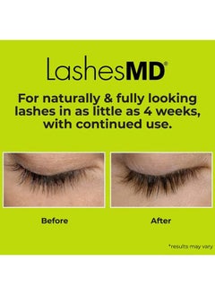 LashesMD Eyelash Growth Serum & Eyelash Conditioner for Naturally Fuller Looking Eyelashes and Eyebrows In As Little As Four Weeks  - Image 4