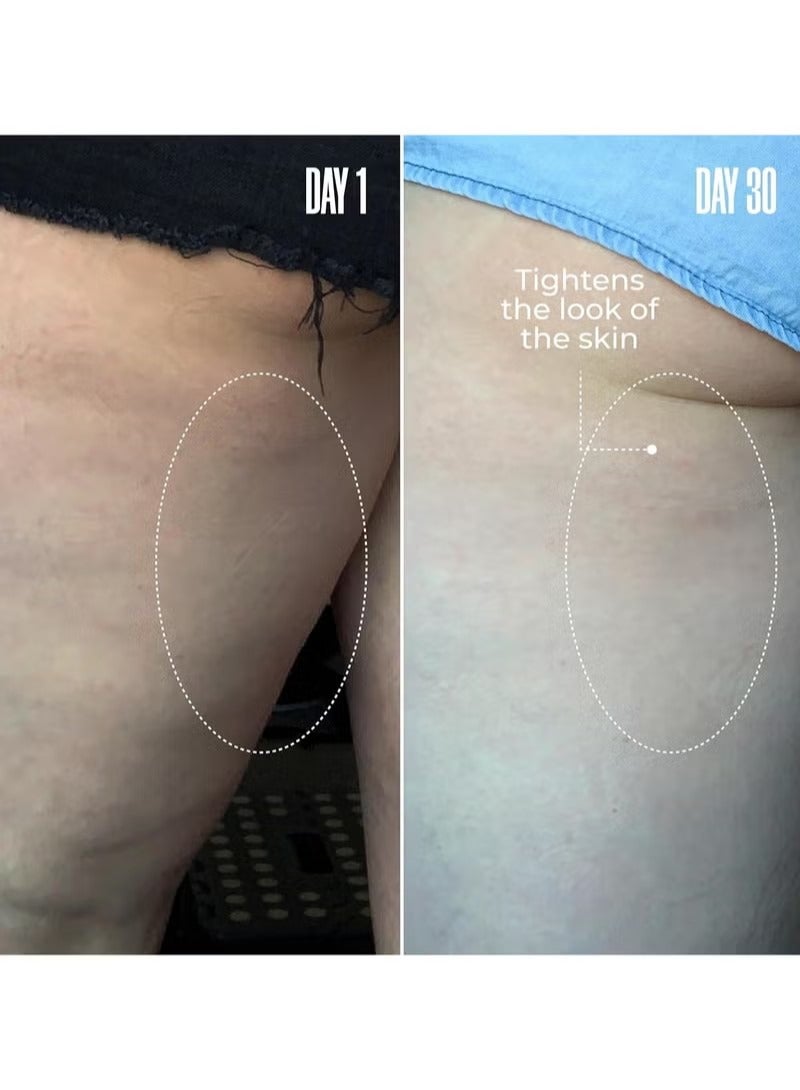 Maelys Cosmetics B-TIGHT Leave-On Cellulite Mask - Reduces The Appearance Of Cellulite - Visibly Tightens The Skin In The Butt Area - Image 5