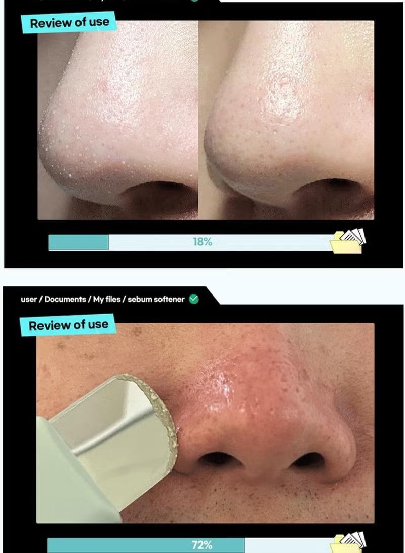 ilso Super Melting Sebum Softener, Pore Cleansing Solution, Melts Away Blackheads & Sebum, Korean Skincare - Image 5
