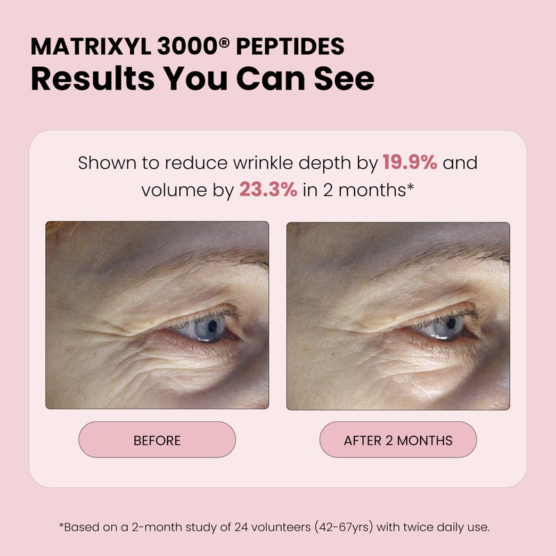 simplified skin Rose Water Spray for Face with Matrixyl 3000 - Organic Rosewater Face Mist with Aloe Vera & Hyaluronic Acid - Hydrating, Reduces Fine Lines, Boosts Collagen Production, & Soothes Skin - 4 Fl Oz - Image 4