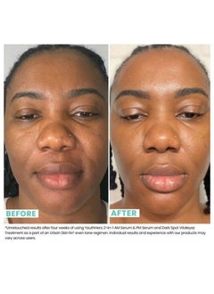 Urban Skin Rx Youthhero Am/Pm Serums 2In1 Dualformula Delivery Targets Sun Damage + Discolorations Fine Lines + Wrinkles & Visibly Firms Skin Cruelty Free All Skin Types 1.0 Fl Oz Total  - Image 2
