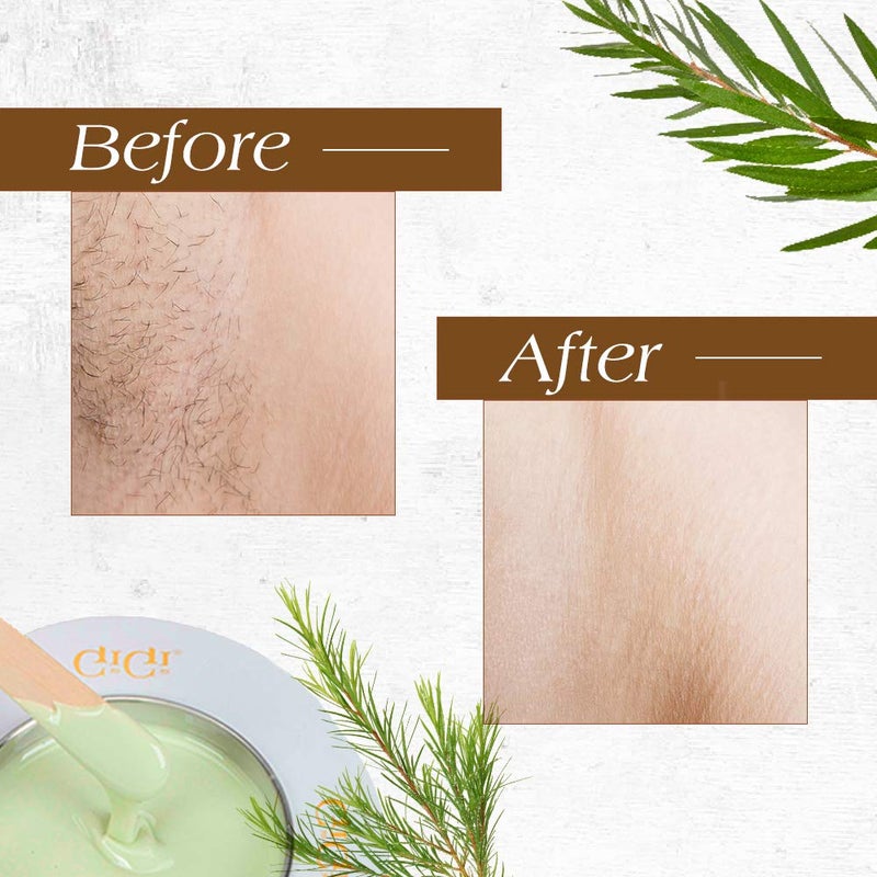 GiGi Tea Tree CrÃ¨me Wax - Soothing Hair Removal Wax for Sensitive Skin, Soft Wax for Face & Body, Calming Formula with Tea Tree Oil, 14 oz - Image 3
