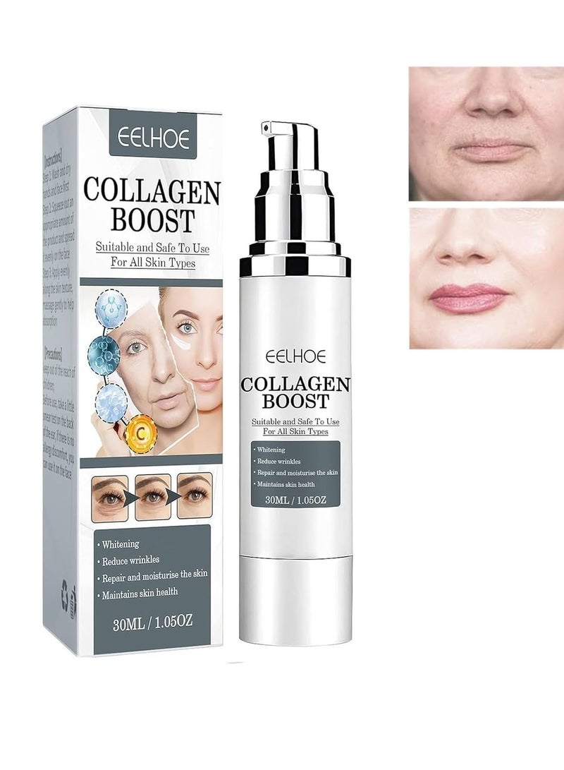 EELHOE Collagen Infusion Serum Resilience Serum for Timeless Beauty Age-Defying Elegance Ageless Transformation Boost Serum - Image 1