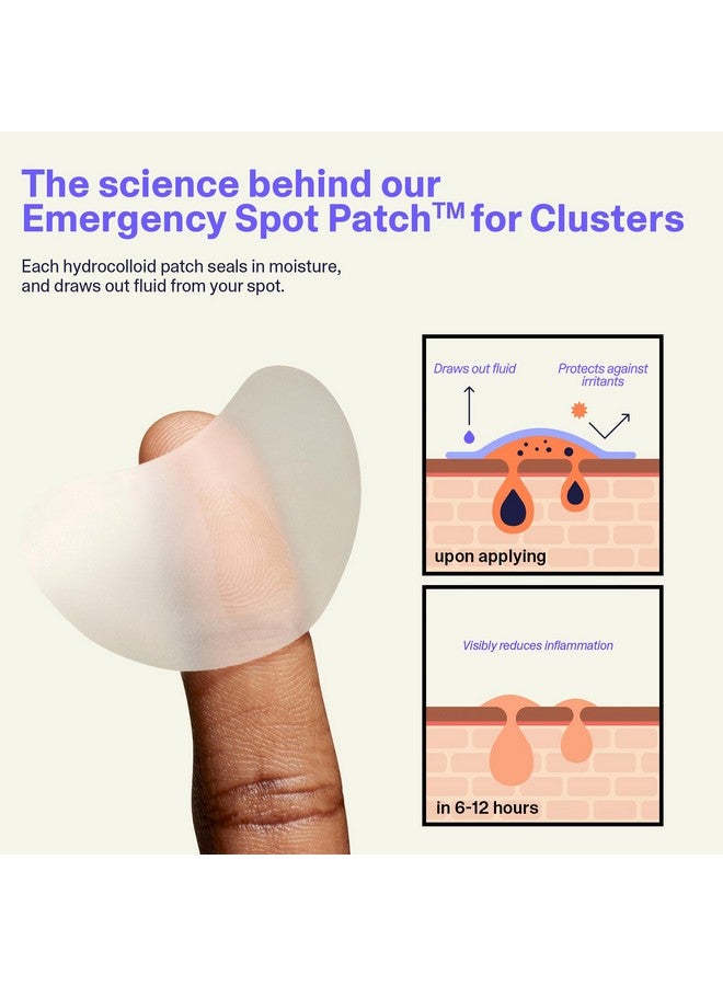 Curology Emergency Spot Patch Clusters for Breakouts, Fast Acting Large Hydrocolloid Pimple Patches for Face, Oil Absorbing, 14 Count - Image 4