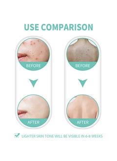 EELHOE Razor Bump Solution，Prevents Ingrown Hair Reduce Dark Spot Reduce Redhess And Bumps，Hair Growth Inhibitor Safe and Gentle, Delay Hair Growth, No Black Spots，Roll-on 100ml  - Image 3