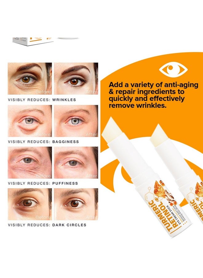 paminify - Turmeric Retinol Eye Stickeye Balm Stick Hydrating For Dark Circlewrinklesvisible Results In 34 Weeksanti Aging Under Eyeretinol Eye Cream For Puffiness And Bags Reduces Fine Lines - Image 1