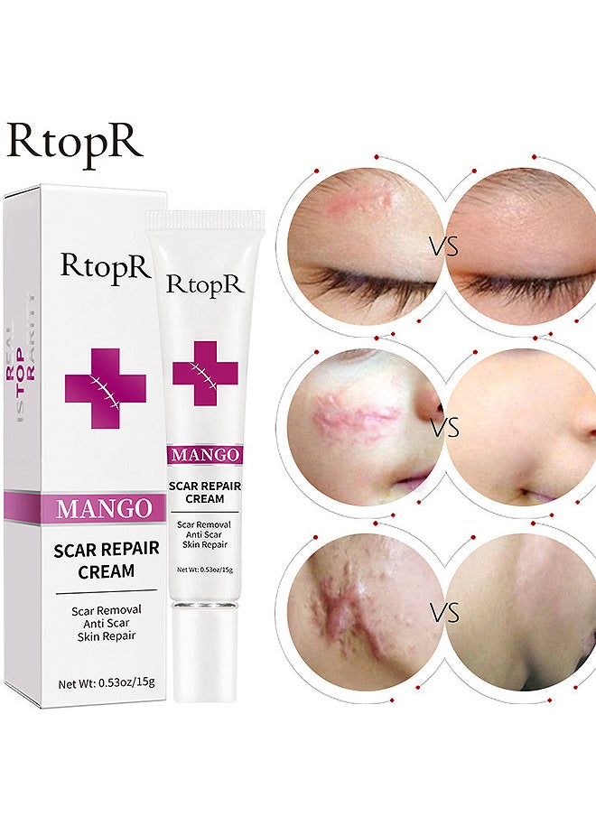 RtopR - Scar Removal Cream Skin Repair Creams Treatment Stretch Marks Acne Surgical Care 15G - Image 1