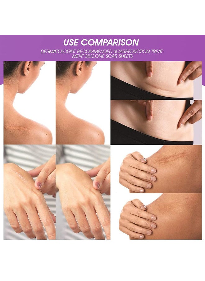 RtopR - Scar Removal Cream Skin Repair Creams Treatment Stretch Marks Acne Surgical Care 15G - Image 1