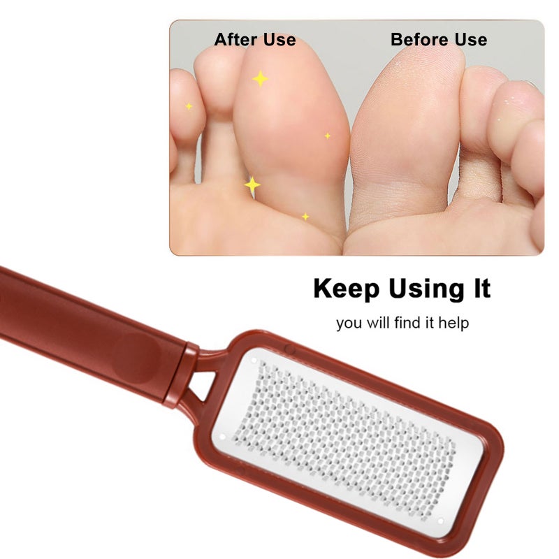 Foot File for Callus Trimming & Dead Skin Removal Stainless Steel Surface Pedicure Feet Rasp with Adjustable Length Cracked Skin Corns Callus Remover - Image 4