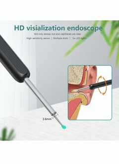 GKK Ear Wax Removal Kit - Ear Wax Removal with Camera Wi-Fi Visible Descaling Spoon with 4 Soft Silicone Ear Spoons Wireless Ear Endoscope 1296P HD with LED Light for iPhone/iPad/Android Phone (Black)  - Image 2