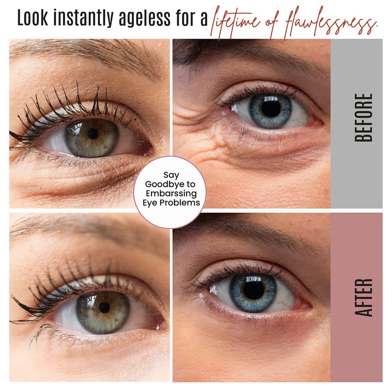 Dermaxgen Instant Eyelift Cream Time Reverse Treatment For Dark Circles, Puffy Eyes, & Wrinkles Anti Aging Serum Reduces Under Eye Bags, Wrinkles, Dark Circles, Fine Lines & Crow's Feet Instantly - 12 - Image 5