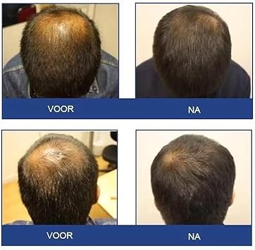 Foligain Mens AntiHair Loss Shampoo 2 Trioxidil Protects Fine and Thinning Hair Natural Ingredients - Image 4