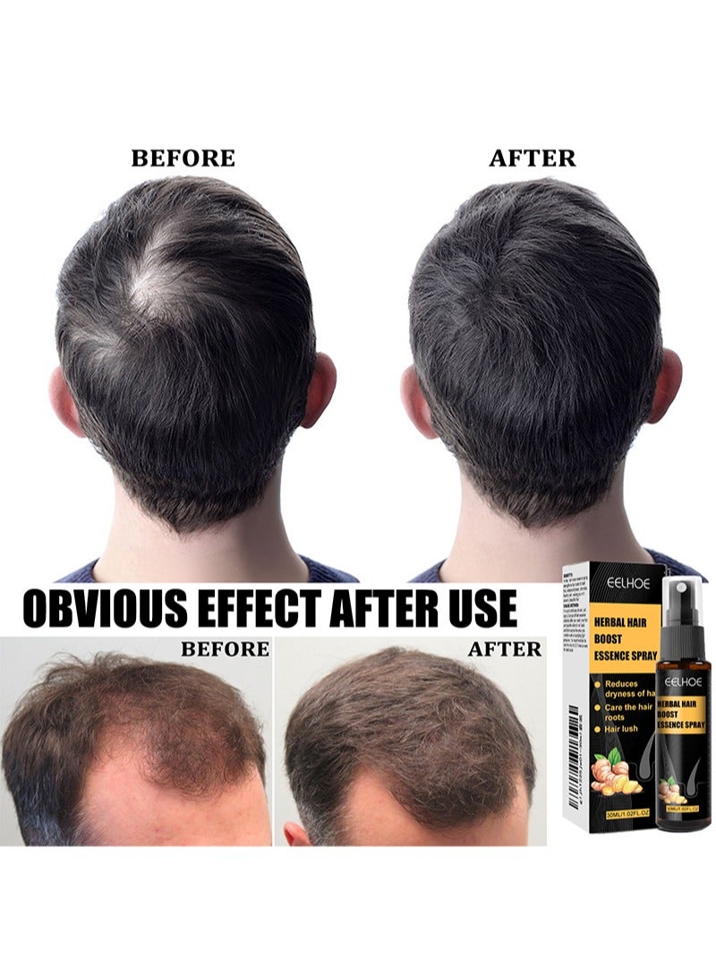 EELHOE Natural Herbal Hair Boost Essence Spray Set, Anti Hair Loss Serum，Hair Growth Essence Spray for Bald Head，Nourishing Beard Hair Oil Spray with Mini Roller-30ml - Image 4