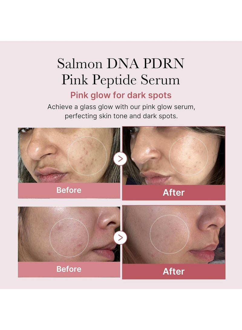 ميديكيوب سلمون DNA PDRN مصل الببتيد الوردي، مصل التوهج الوردي، الببتيد، نياسيناميد، ترطيب وترطيب وتقوية، لون الجلد غير المتساوي، العناية بالبشرة الكورية 1.01 أوقية فلورية. (1.01 أوقية فلورية، سلمون DNA PDRN) - Image 2