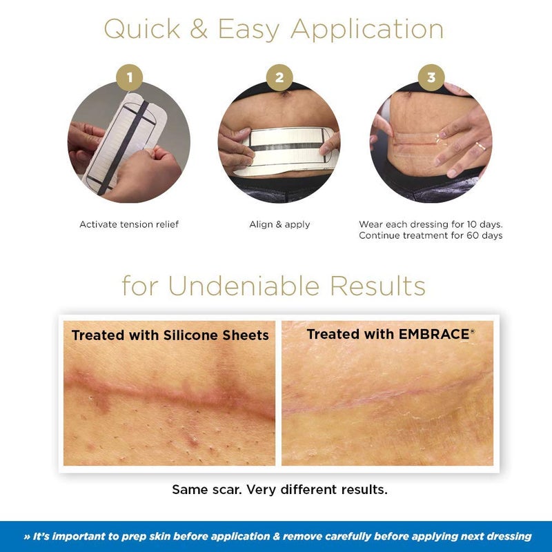 Embrace Active Scar Defense for New Scars, FDA-Cleared Medical-Grade Silicone Scar Sheets for Hypertrophic & Keloid Scar Treatment, 4.7 Inch, Large, 30-Day Supply - Image 3