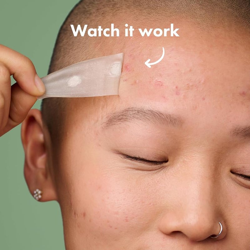 Mighty Patch Surface - Hydrocolloid Large Acne Pimple Patch Spot Treatment (10 count) for Body and Larger Breakouts on Cheek, Forehead, Chin, Vegan, Cruelty-Free, 50% Better Absorption - Image 3