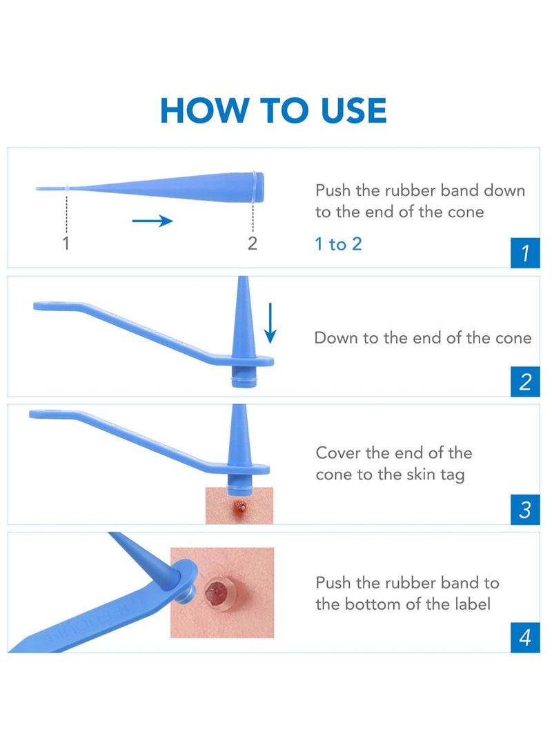 2 in 1 Wart Removal Tool Skin Tag Removal Double Head Kit Painless Easy-Using Device for Small to Large Sized Skin Tag on Face Neck and Body Blue