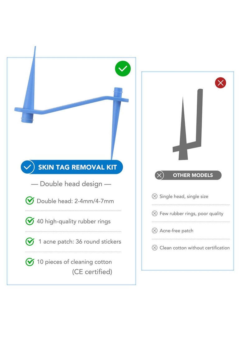 2 in 1 Wart Removal Tool Skin Tag Removal Double Head Kit Painless Easy-Using Device for Small to Large Sized Skin Tag on Face Neck and Body Blue
