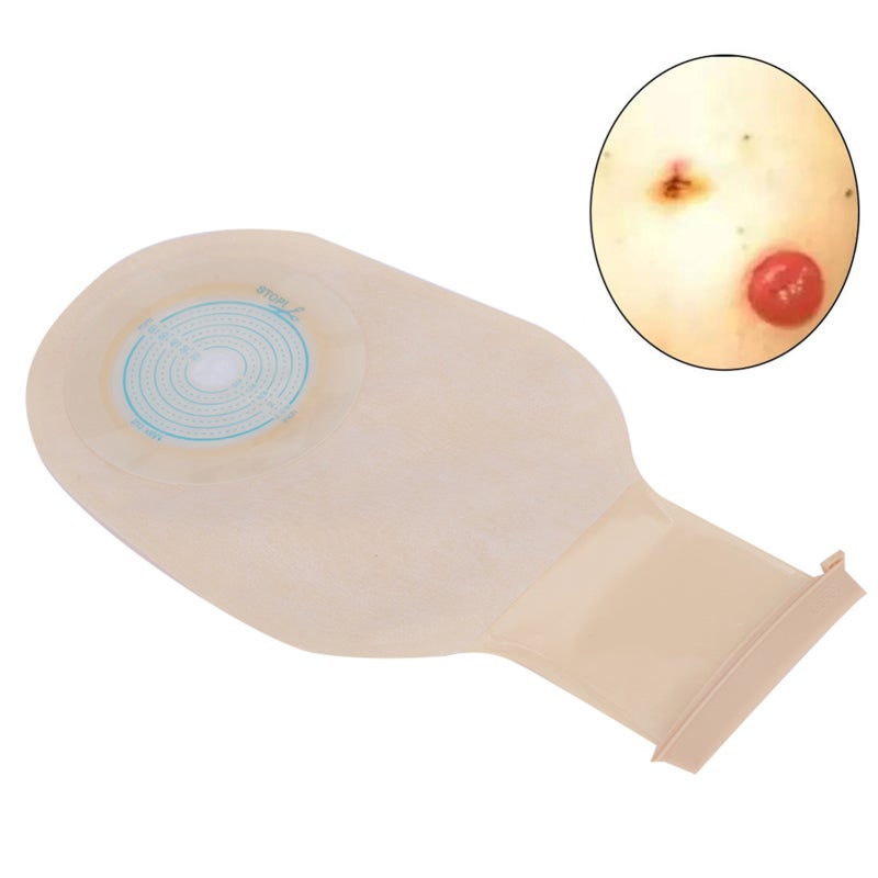 10pcs Disposable Colostomy Bag Soft Skin Friendly Colostomy Pouch Bag(Open Type ) - Image 4