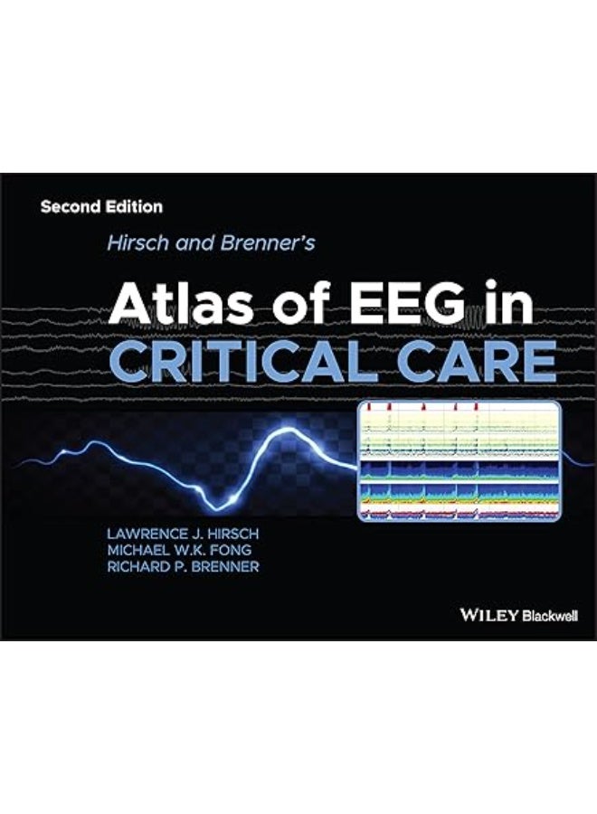 Atlas of EEG in Crtical care