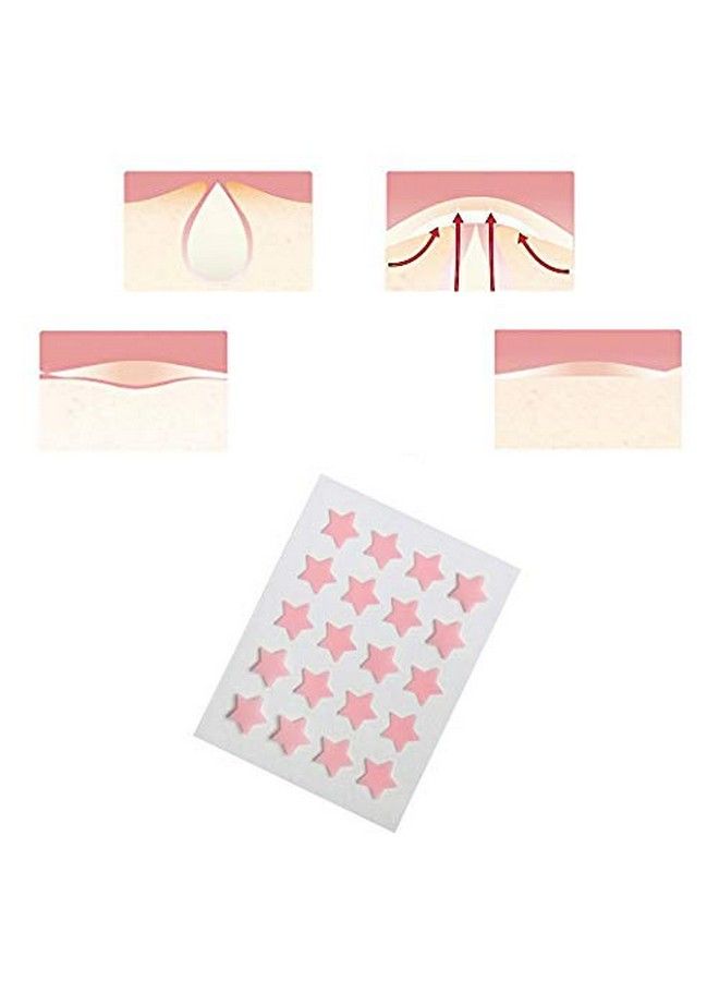AGRCARE Acne Pimple Patch Hydrocolloid Pimple Patches For Face Zit Patch Acne Dots Clear Acne Stickers (2 Pack)  - Image 5