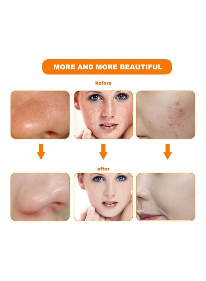 Captaintech Colour Optical Whitening Face Mask With Remote Kit White/Black 230x200mm - Image 3