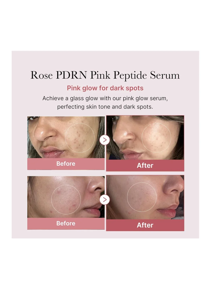 Medicube Medicube PDRN Pink Peptide Serum, Pink glow serum, Vegan PDRN, Peptide, Niacinamide, Hydrating & Moisturizing & Firming, Uneven Skin Tone, Pore Care, Korean Skincare