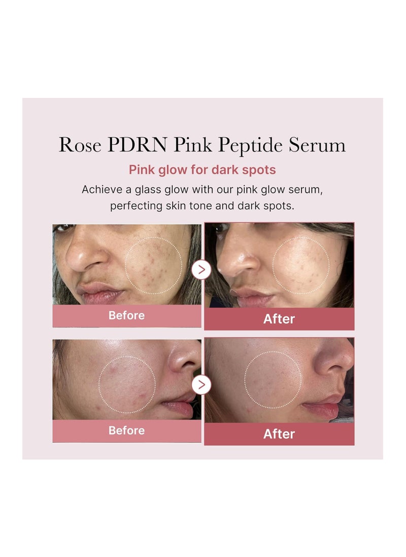 Medicube - Medicube PDRN Pink Peptide Serum, Pink glow serum, Vegan PDRN, Peptide, Niacinamide, Hydrating & Moisturizing & Firming, Uneven Skin Tone, Pore Care, Korean Skincare - Image 1