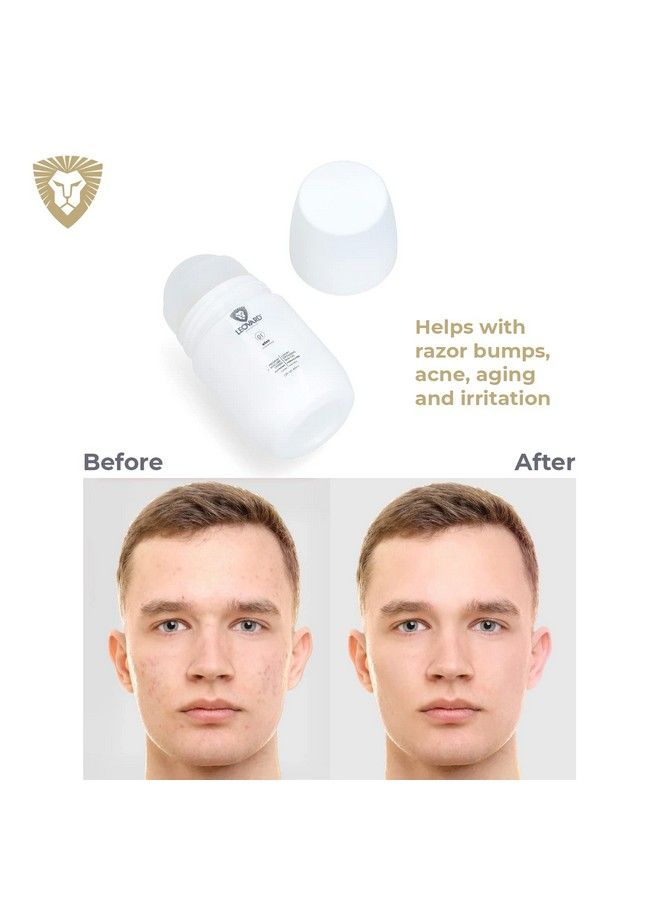 leovard Razor Burn Treatment For Women & Men Ingrown Hair Serum Roll On Razor Bump Treatment Aftershave Serum For Bikini Area Legs Face And Underarms W Hyaluronic Acid Salicylic Acid & Blend Of Essential Oils - Image 5