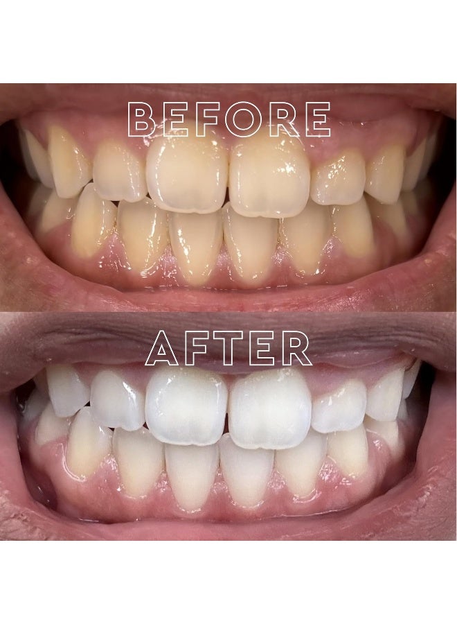 MOON Dissolving Teeth Whitening Strips 28 Platinum Express No Rinse White Strips Winter Mint Hydrogen Peroxide Essential Oils Whiten Sensitive Teeth up to 8 Shades in 1 Week Travel Essentials - Image 4