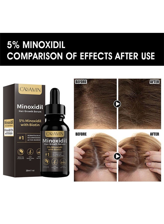 CANAMIN 5% Minoxidil Hair Growth Serum Oil For Men and Women, Biotin Hair Serum, Safest Hair Regrowth Treatment, Prevent Scalp Hair Loss 30ml - Image 5