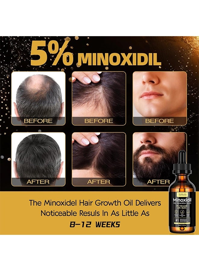 CANAMIN 5% Minoxidil Hair Growth Serum Oil For Men and Women, Biotin Hair Serum, Safest Hair Regrowth Treatment, Prevent Scalp Hair Loss 30ml - Image 4
