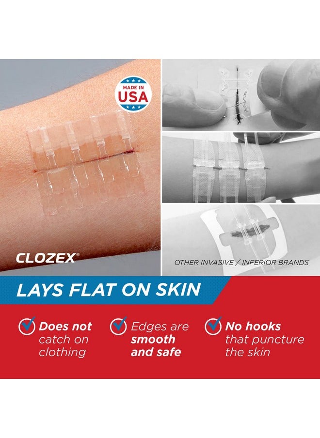 Clozex Clozex Complete Emergency Laceration Kit - Repair Wounds Without Stitches. FDA Cleared Skin Clean Cover Closure Device for 2 Individual Or Combine for 2 1/2 in. Length  - Image 4