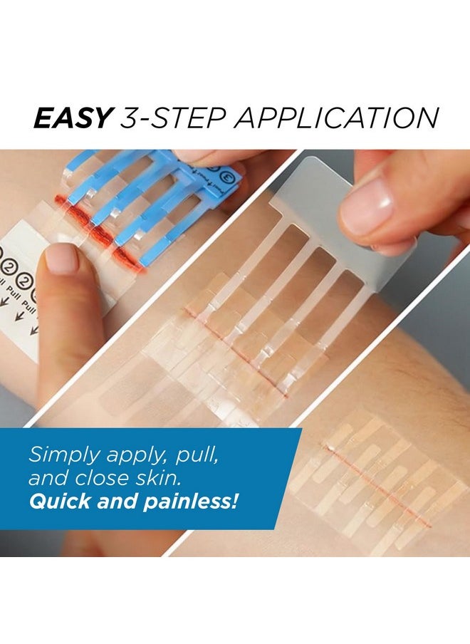 Clozex Clozex Complete Emergency Laceration Kit - Repair Wounds Without Stitches. FDA Cleared Skin Clean Cover Closure Device for 2 Individual Or Combine for 2 1/2 in. Length  - Image 5