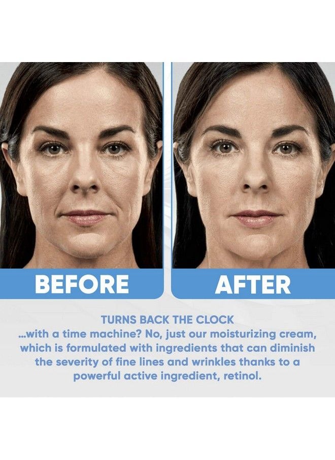 Estetist - Face Moisturizer 25% Organic Retinol Cream With Hyaluronic Acid Anti Aging Wrinkles & Fine Lines - Image 1